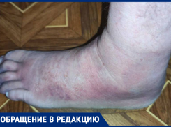 Хирург смотрел фотографию снимка рентгенограммы на телефоне: травмировавший ногу житель ДНР рассказал о ноу-хау в Старобешевской ЦРБ