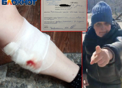 Своры агрессивных собак оккупировали Азотный в Донецке, власти разводят руками