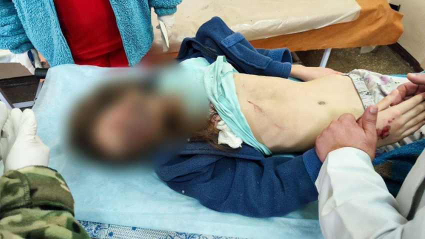 Один ребенок погиб и двое ранены в результате утреннего обстрела Пантелеймоновки ДНР со стороны ВСУ
